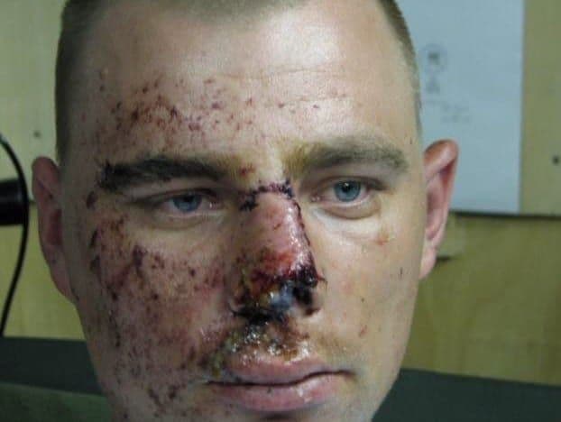 Figure 1. Eye protection worked after vehicle hit by rocket-propelled grenade. Photo credit: COL Darrel K. Carlton