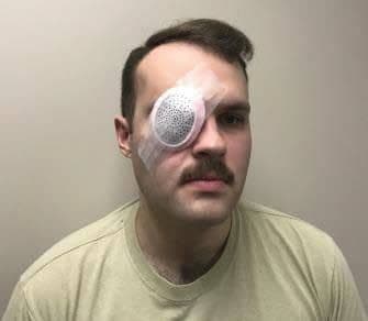 Figure 31a. Fox shield.