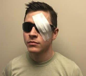 Figure 31b. Can use member’s own eye protection if intact or minor damage.