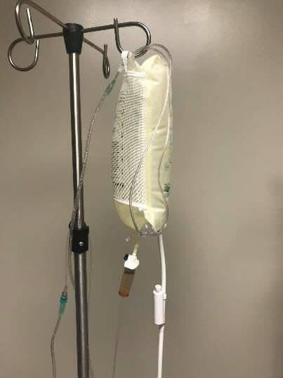 Figure 32a. Normal saline or lactated ringers inside pressure infuser.