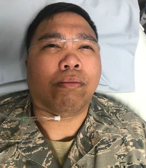 Figure 32c. Position nasal cannula on forehead so prongs provide continuous irrigation into both eyes.