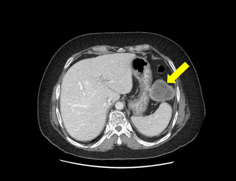 A close-up of a ct scan

Description automatically generated with low confidence