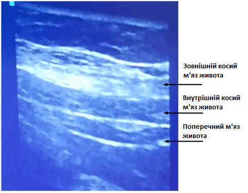 QL блокада - 2.png