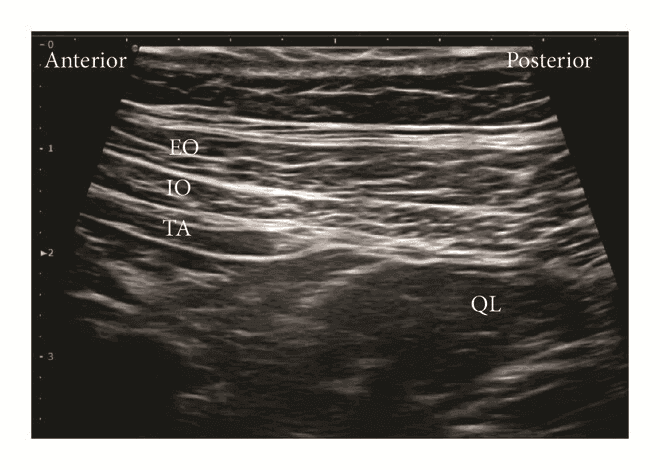 QL блокада - 5а.png