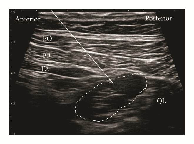 QL блокада - 5б.png