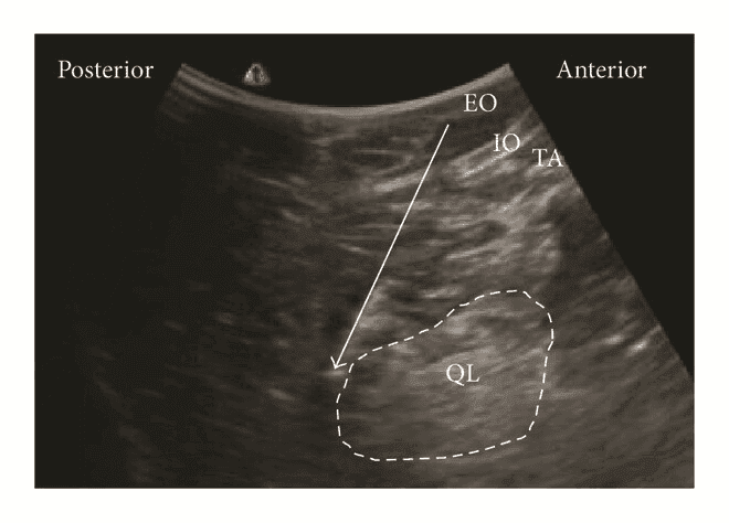 QL блокада - 6а.png