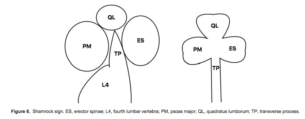 QL блокада - 7.png