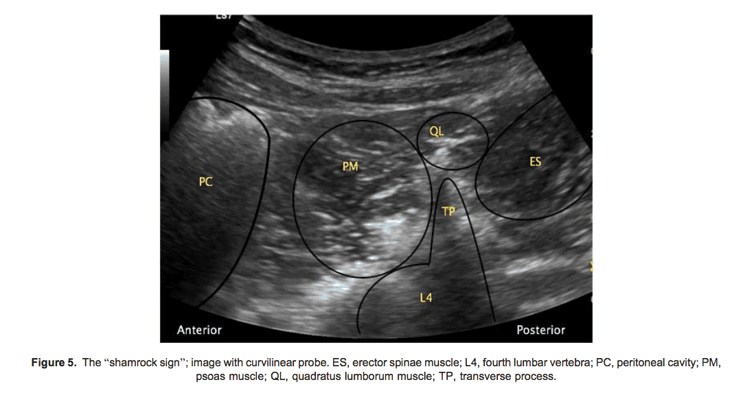 QL блокада - 8.png