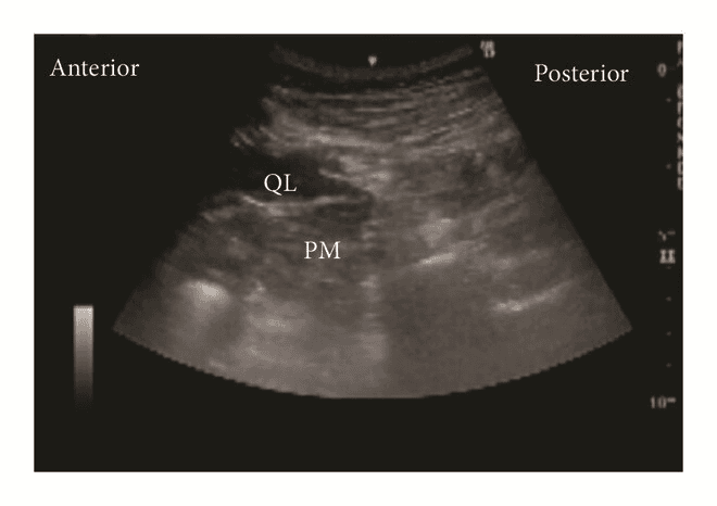 QL блокада - 9а.png